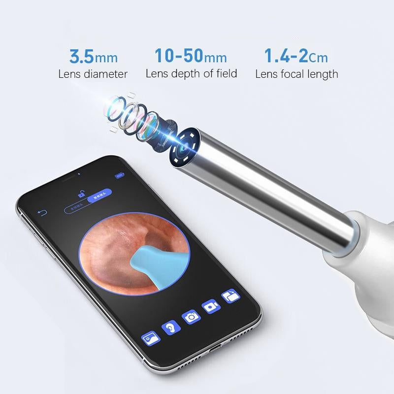 ClinEar™ 10-in-1 HD Ear Wax Removal Camera